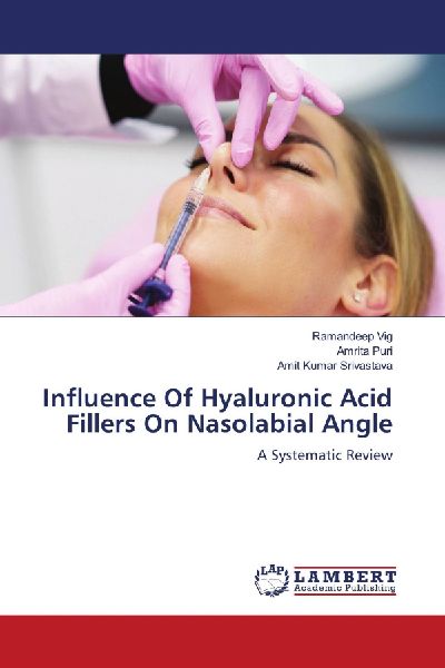 Influence Of Hyaluronic Acid Fillers On Nasolabial Angle: A Systematic Review