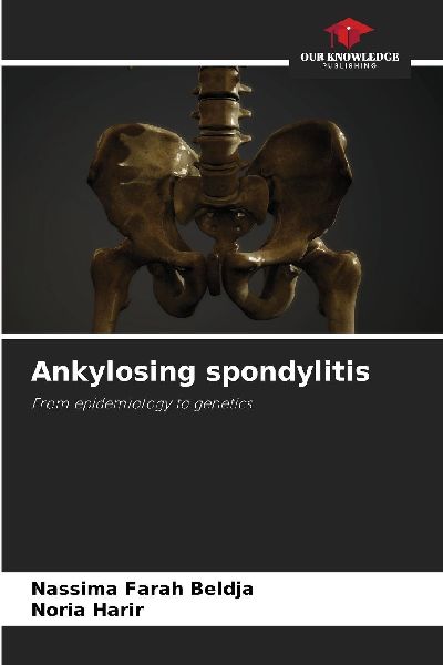Ankylosing spondylitis: From epidemiology to genetics