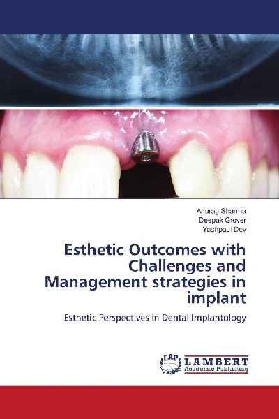 Esthetic Outcomes with Challenges and Management strategies in implant: Esthetic Perspectives in Dental Implantology