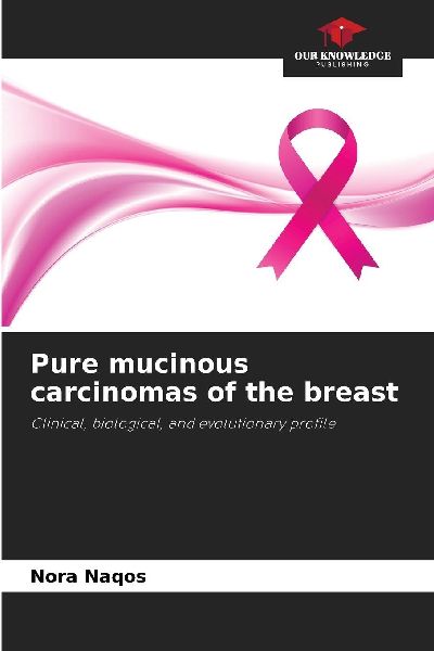 Pure mucinous carcinomas of the breast: Clinical, biological, and evolutionary profile