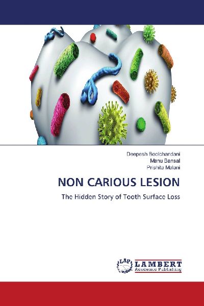 NON CARIOUS LESION: The Hidden Story of Tooth Surface Loss