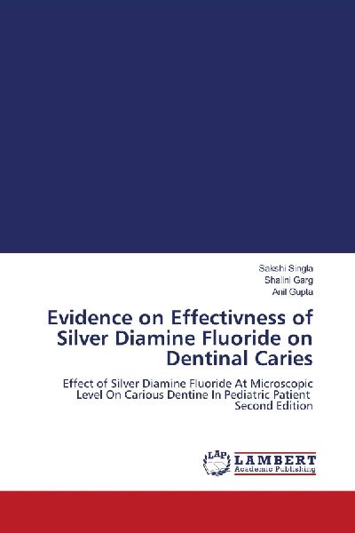 Evidence on Effectivness of Silver Diamine Fluoride on Dentinal Caries: Effect of Silver Diamine Fluoride At Microscopic Level On Carious Dentine In Pediatric Patient Second Edition