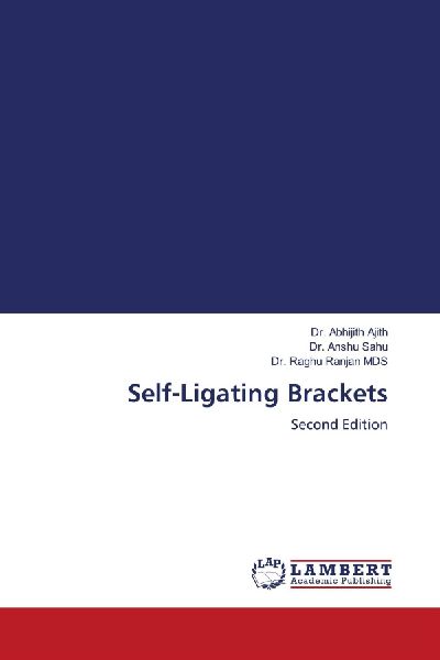 Self-Ligating Brackets: Second Edition