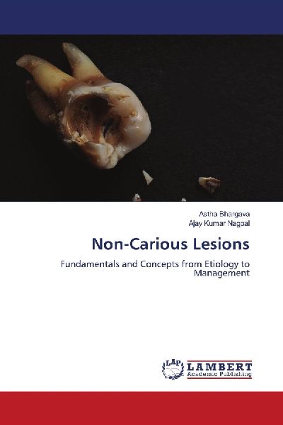 Non-Carious Lesions: Fundamentals and Concepts from Etiology to Management