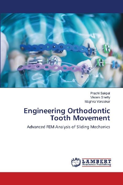Engineering Orthodontic Tooth Movement: Advanced FEM Analysis of Sliding Mechanics