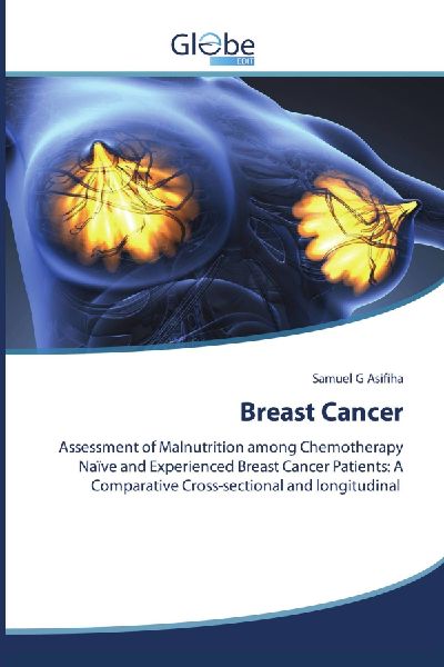 Breast Cancer: Assessment of Malnutrition among Chemotherapy Naïve and Experienced Breast Cancer Patients: A Comparative Cross-sectional and longitudinal