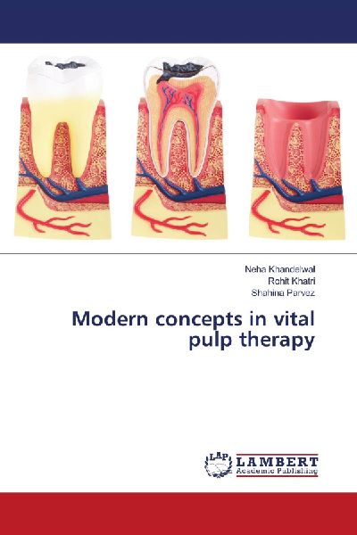 Modern concepts in vital pulp therapy
