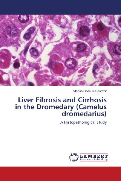 Liver Fibrosis and Cirrhosis in the Dromedary (Camelus dromedarius): A Histopathological Study