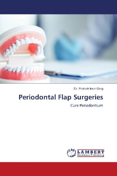 Periodontal Flap Surgeries: Cure Periodontium