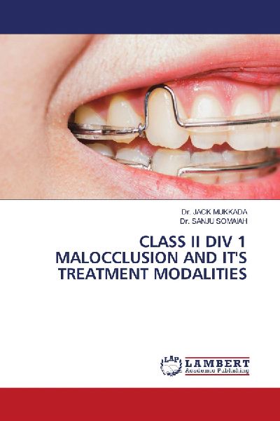 CLASS II DIV 1 MALOCCLUSION AND IT'S TREATMENT MODALITIES