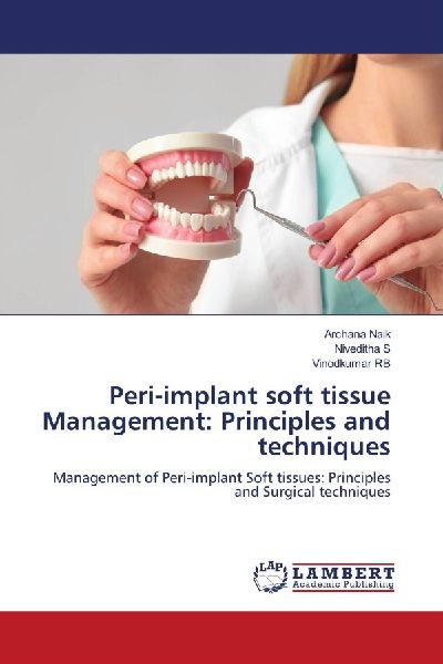 Peri-implant soft tissue Management: Principles and techniques: Management of Peri-implant Soft tissues: Principles and Surgical techniques