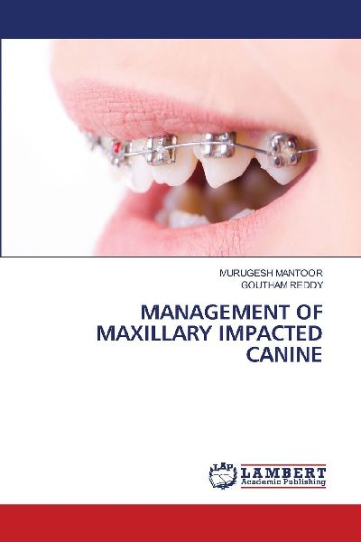 MANAGEMENT OF MAXILLARY IMPACTED CANINE