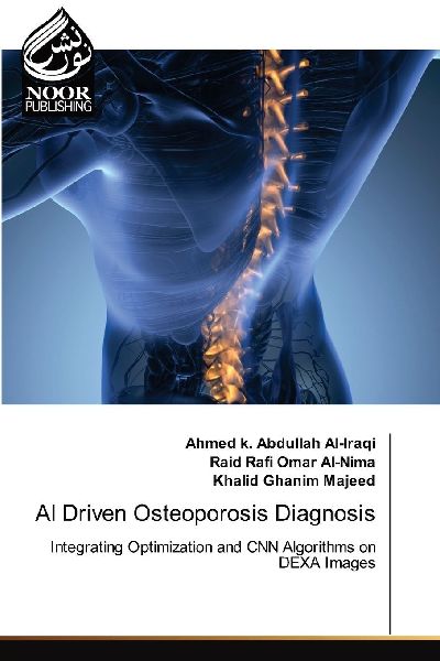 AI Driven Osteoporosis Diagnosis