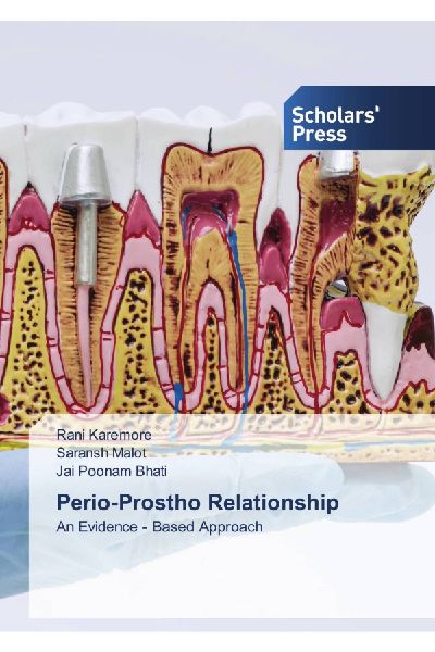 Perio-Prostho Relationship: An Evidence - Based Approach
