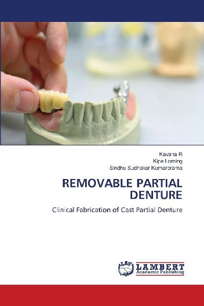 REMOVABLE PARTIAL DENTURE: Clinical Fabrication of Cast Partial Denture