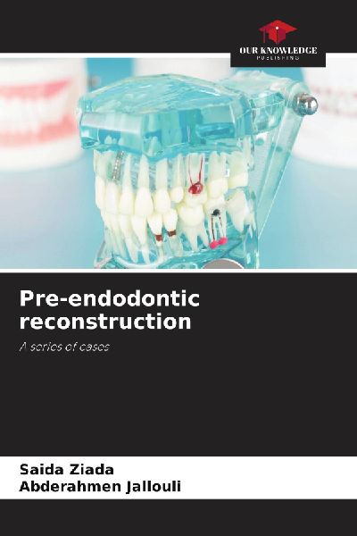Pre-endodontic reconstruction: A series of cases