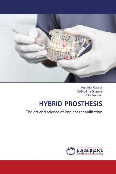 HYBRID PROSTHESIS: The art and science of implant rehabilitation