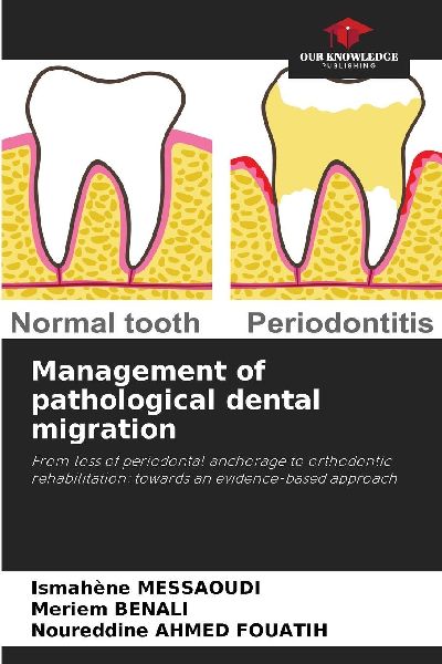 Management of pathological dental migration: From loss of periodontal anchorage to orthodontic rehabilitation: towards an evidence-based approach