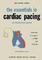 the essentials in cardiac pacing: An Illustrated Guide