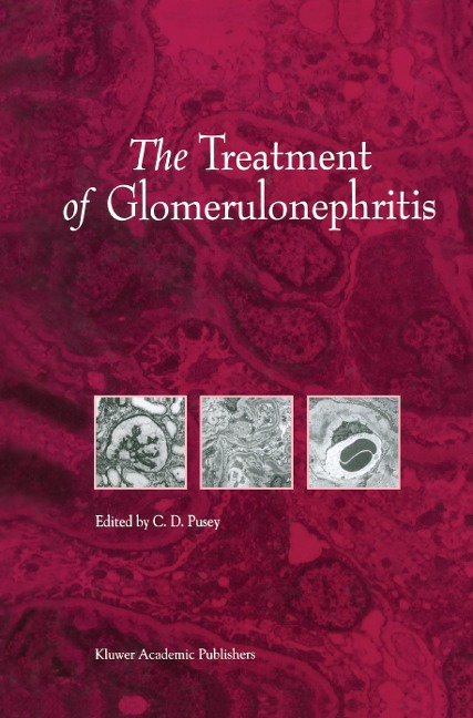 The Treatment of Glomerulonephritis