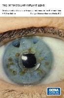 The Intraocular Implant Lens Development and Results with Special Reference to the Binkhorst Lens: Proefschrift