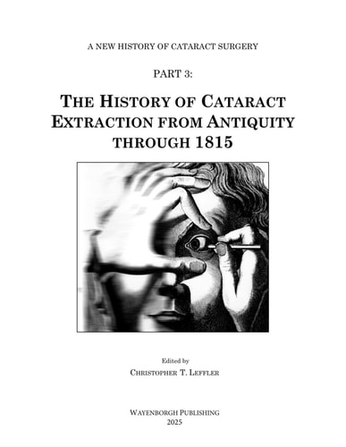 The History of Cataract Extraction from Antiquity Through 1815