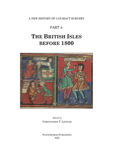 The History of Cataract Surgery The British Isles Before 1800