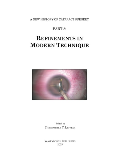 History of Cataract Surgery Refinements in Modern Technique
