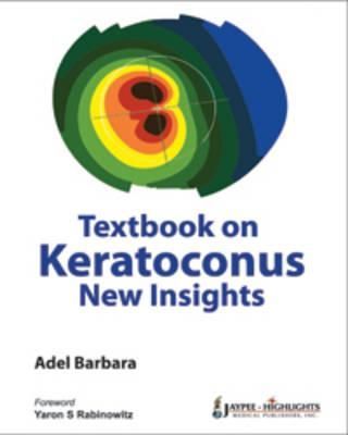 Textbook on Keratoconus: New Insights