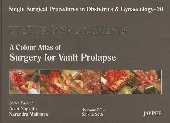Single Surgical Procedures in Obstetrics and Gynaecology - Volume 20 - UTERUS - DISPLACEMENTS: A Colour Atlas of Surgery for Vault Prolapse