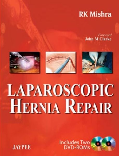 Laparoscopic Hernia Repair