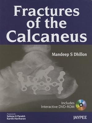 Fractures of the Calcaneus