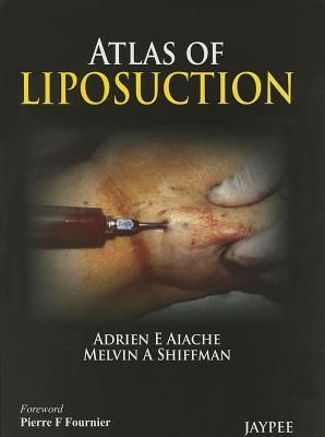 Atlas of Liposuction