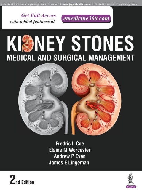 Kidney Stones: Medical and Surgical Management