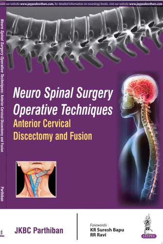 Neuro Spinal Surgery Operative Techniques: Anterior Cervical Discectomy and Fusion