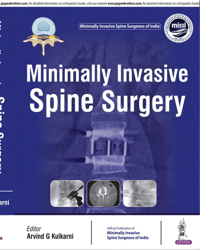Minimally Invasive Spine Surgery