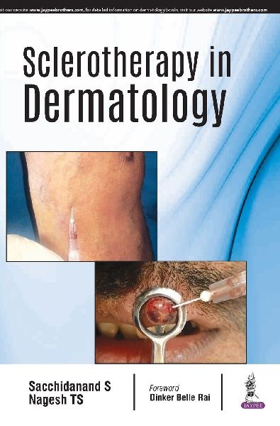 Sclerotherapy in Dermatology