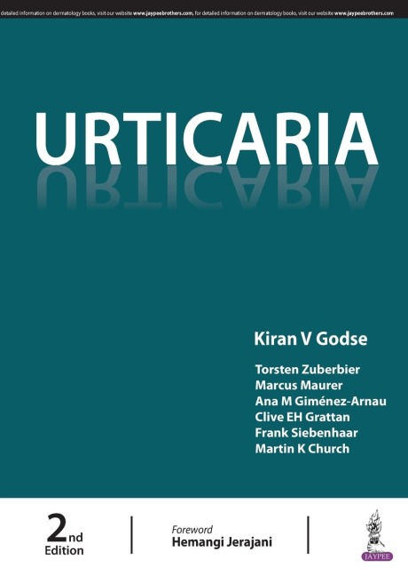 Urticaria