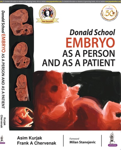 Donald School Embryo as a Person and as a Patient