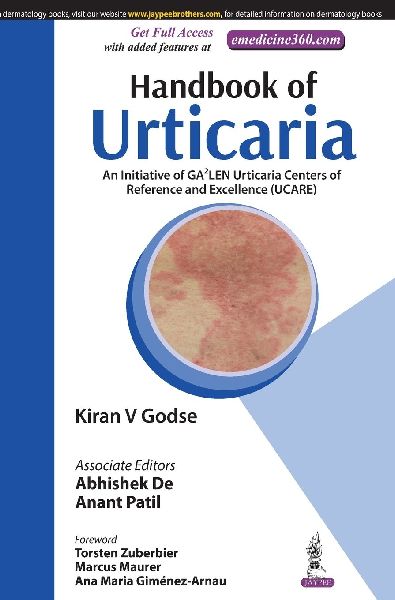 Handbook of Urticaria: An Initiative of GA2LEN Urticaria Centers of Reference and Excellence (UCARE)