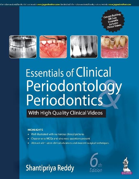 Essentials of Clinical Periodontology & Periodontics