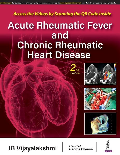 Acute Rheumatic Fever and Chronic Rheumatic Heart Disease