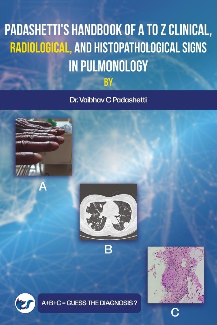 Padashettis Textbook on A to Z Signs in Pulmonology