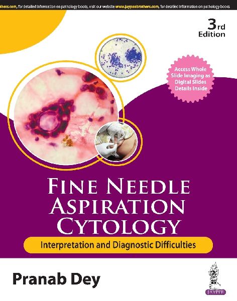 Fine Needle Aspiration Cytology: Interpretation and Diagnostic Difficulties