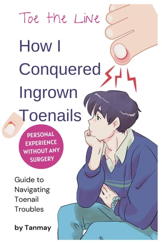 Cure Ingrown Toenails My Personal Story of Achieving Pain-Free Toes Without Surgery: Toe the Line: How I Conquered Ingrown Toenails Without Surgery