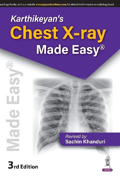 Karthikeyan's Chest X-Ray Made Easy