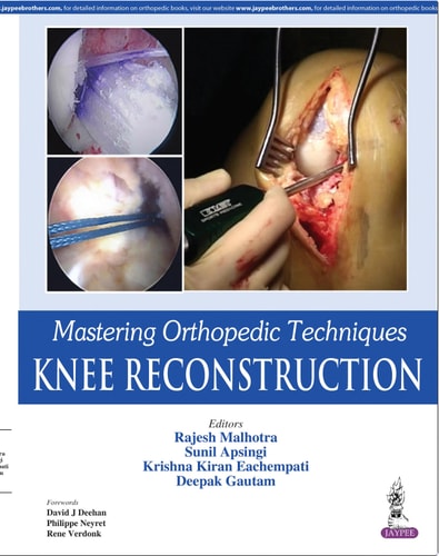 Mastering Orthopedic Techniques: Knee Reconstruction