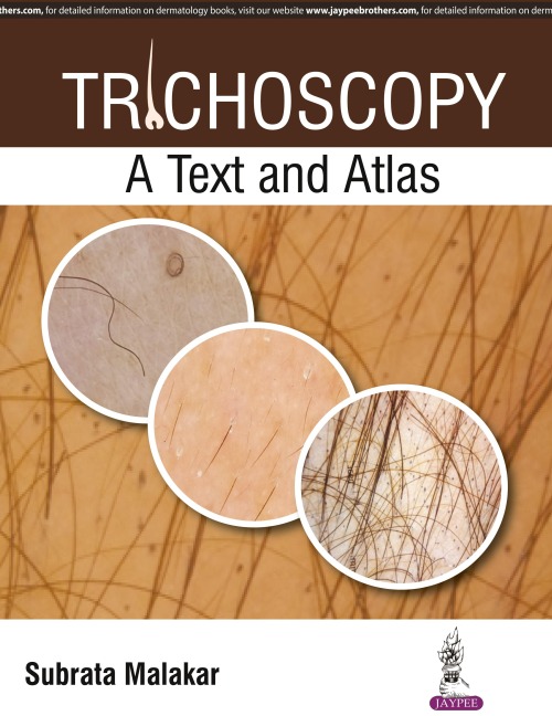 Trichoscopy: A Text and Atlas