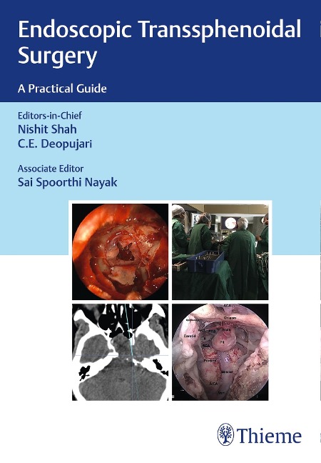 Endoscopic Transsphenoidal Surgery: A Practical Guide