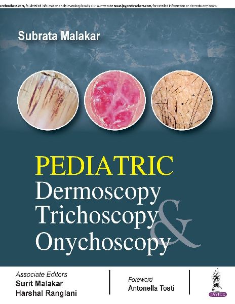 Pediatric Dermoscopy Trichoscopy & Onychoscopy